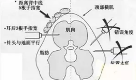 猪好多