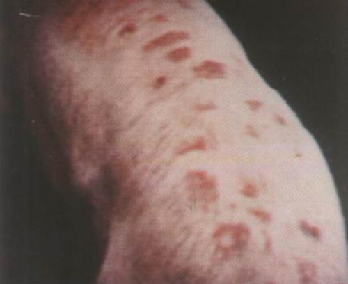 夏季猪身起红斑点怎么办？猪红斑病原因和防治措施分析
