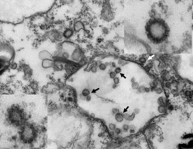 对话华南农业大学科学家：从穿山甲中发现的病毒与新型冠状病毒有99%相似，意味着什么？