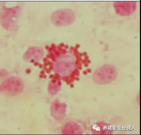 ASFV感染的巨噬细胞周围吸附大量红细胞。