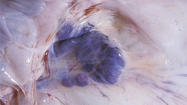 受感染猪的尸检结果，可见肠系膜淋巴结出血