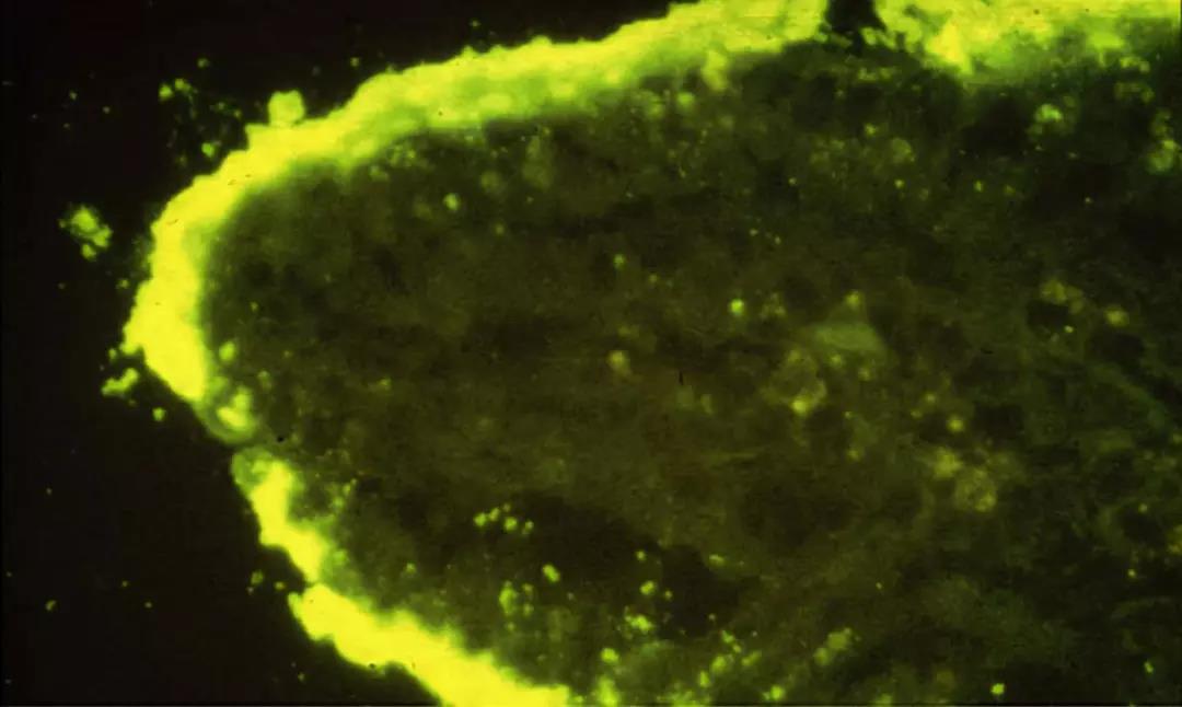 图2 肠绒毛上附着的大肠杆菌密集菌落