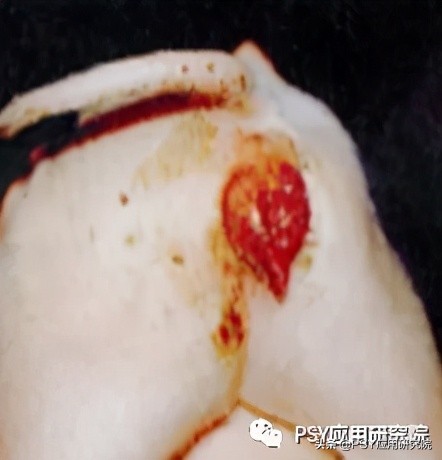 以前仔猪腹泻一针见效，现在为什么不行？