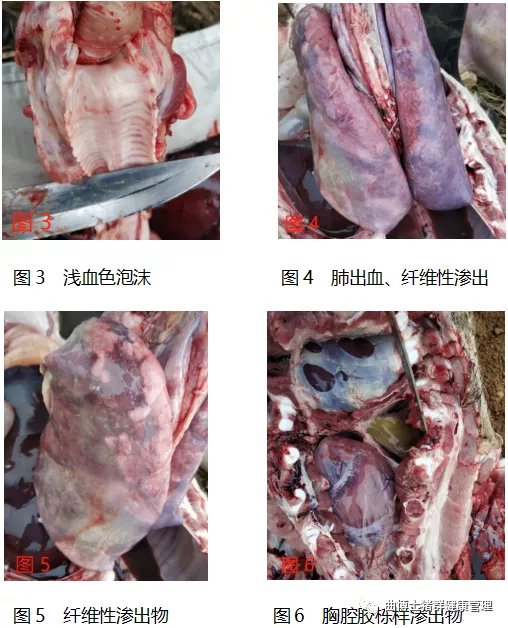 一例猪流感继发传染性胸膜肺炎的临床诊治