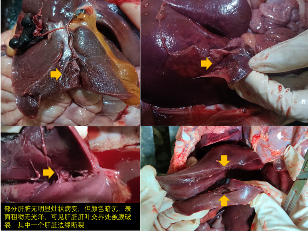 肝被膜图片