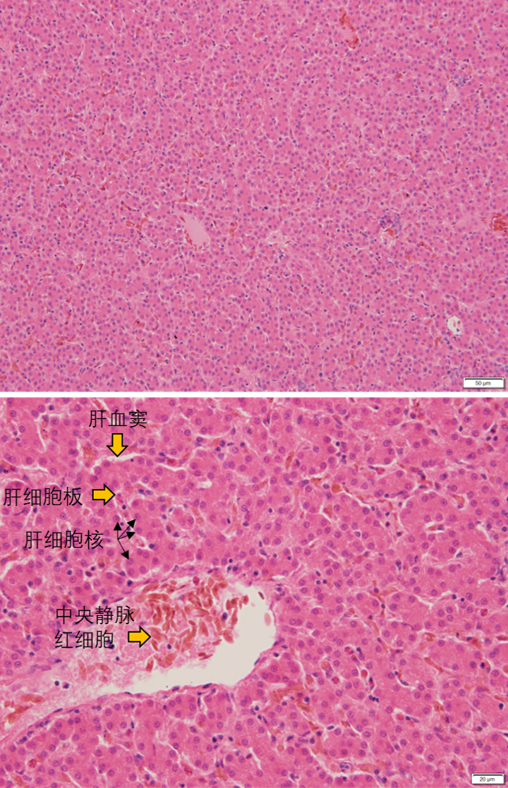 肝脏he染色图片(鸡肝脏,手头没有正常猪肝脏切片)接下来看肝脏的组织