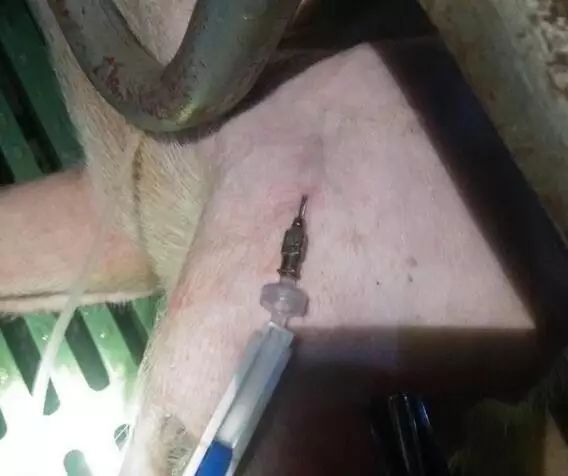 注射方法