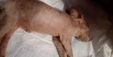 脑炎
