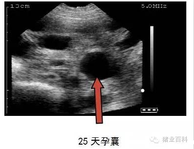 妊娠期孕囊影像