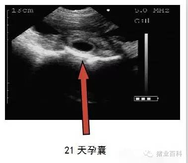 妊娠期孕囊影像