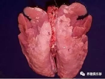肺尖叶与心叶对称性实变