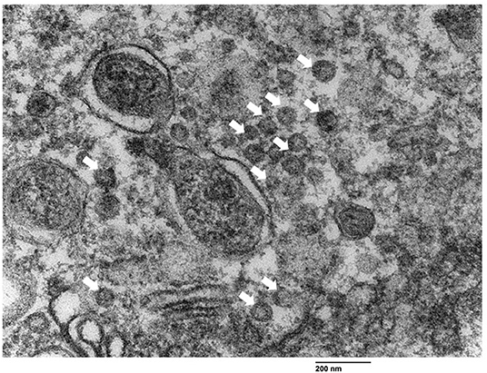 使用透射电子显微镜可视化支气管上皮细胞中的轮状病毒样颗粒（VLP）