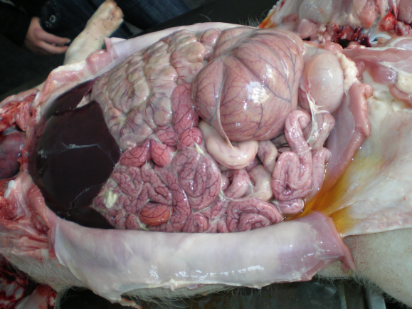腹腔内血色积液