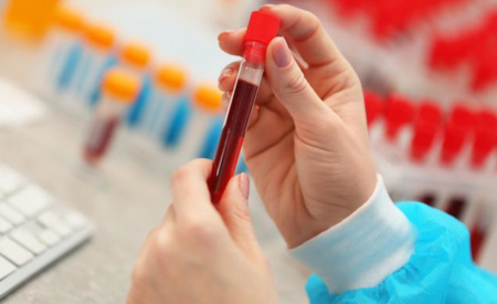 经典猪瘟弱毒活疫苗或 E2 亚单位疫苗接种的母猪所生仔猪的血清动力学分析