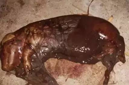 死胎
