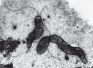 胞内劳森菌感染的回肠、棒状菌体和单极鞭毛