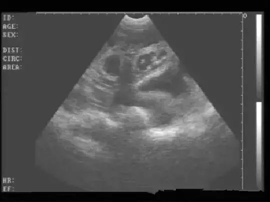 B超检查母猪妊娠，如何识别？这篇图文超详细