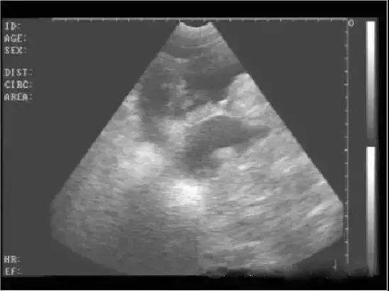 B超检查母猪妊娠，如何识别？这篇图文超详细