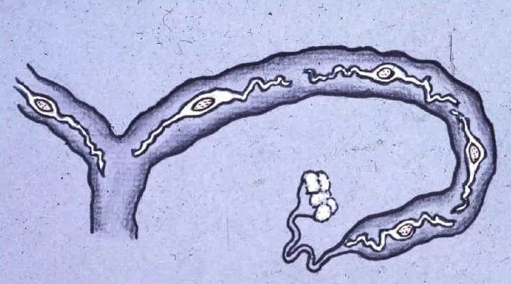 囊胚此时拉长成（2-3英尺）条状，并开始附着在子宫壁上