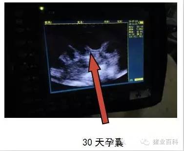 妊娠期孕囊影像