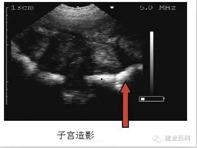 妊娠期孕囊影像