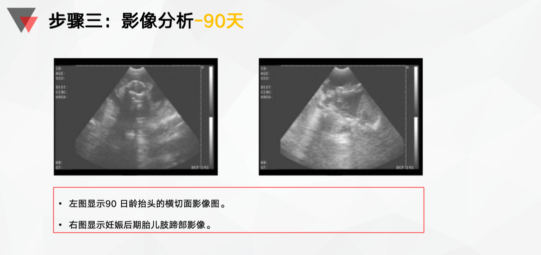 影像分析