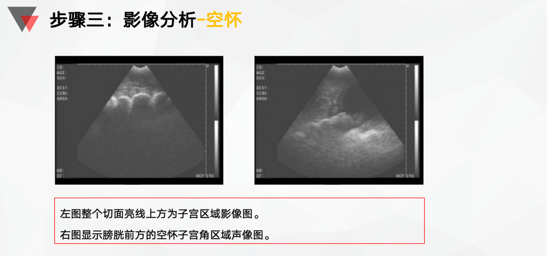 影像分析