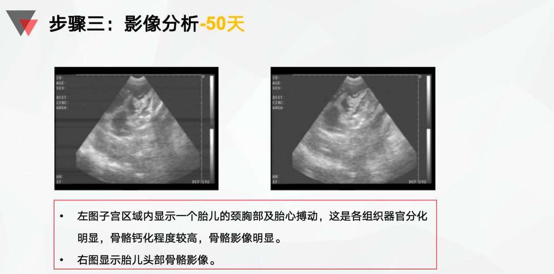 影像分析