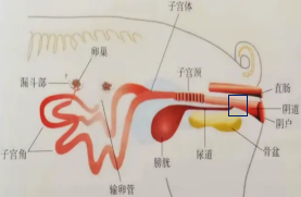 如何防治猪膀胱炎-肾炎综合征？常见问题解析