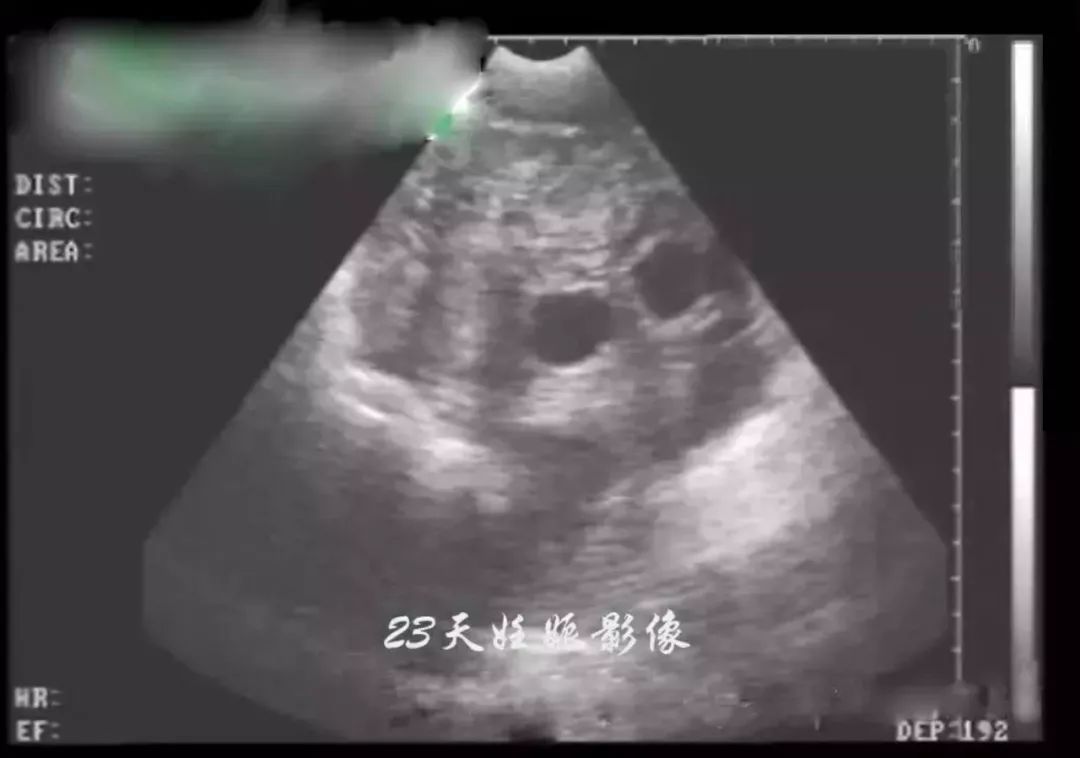 23天妊娠图像