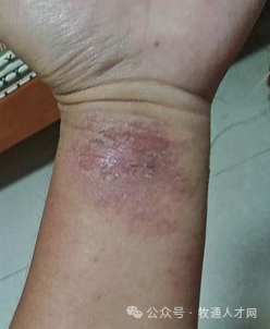 猪场消毒剂泡菜成常态？过度消毒几时休？