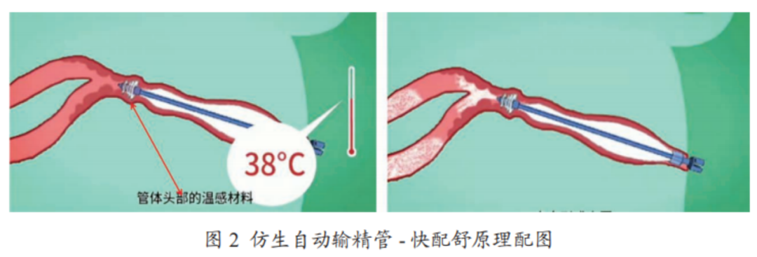 快配舒仿生输精技术：效率与繁殖性能提升的机制解析